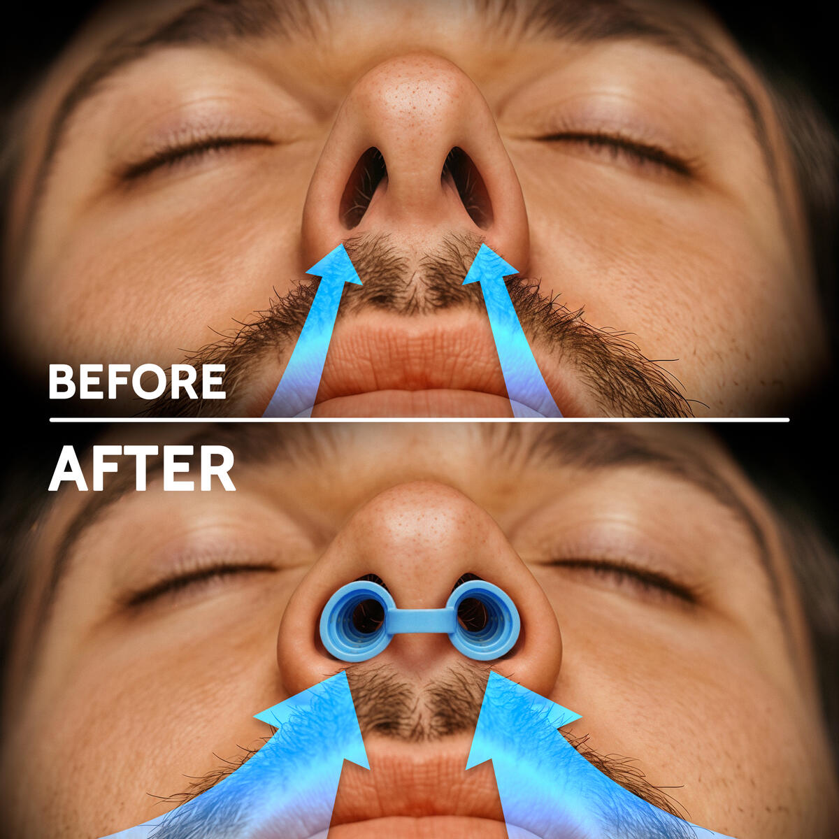 Nasal Dilators Rebate - RebateKey
