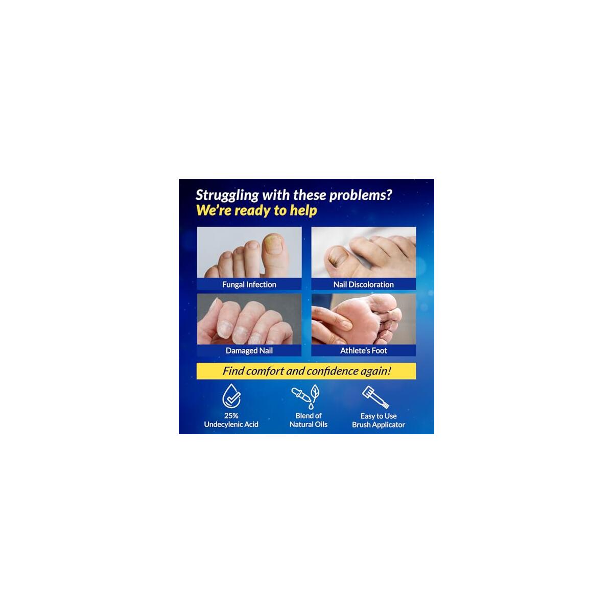 Arflom Toenail Fungus Treatment 2pcs Cashback Rebate - RebateKey