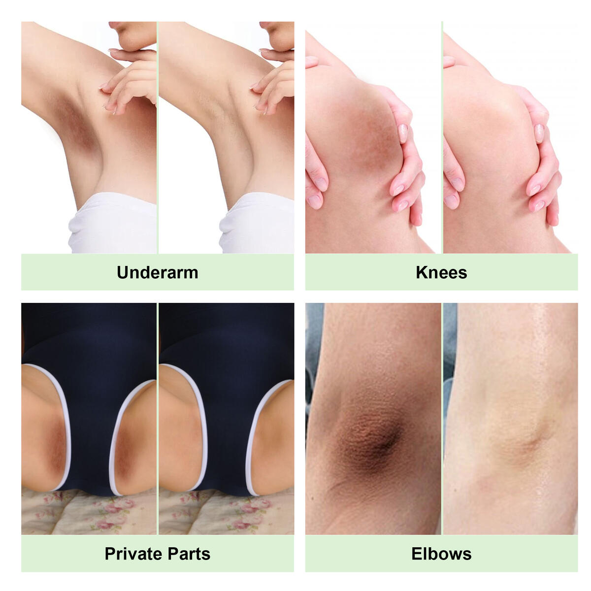Lightening Cream For Intimate Areas Cashback Rebates - RebateKey