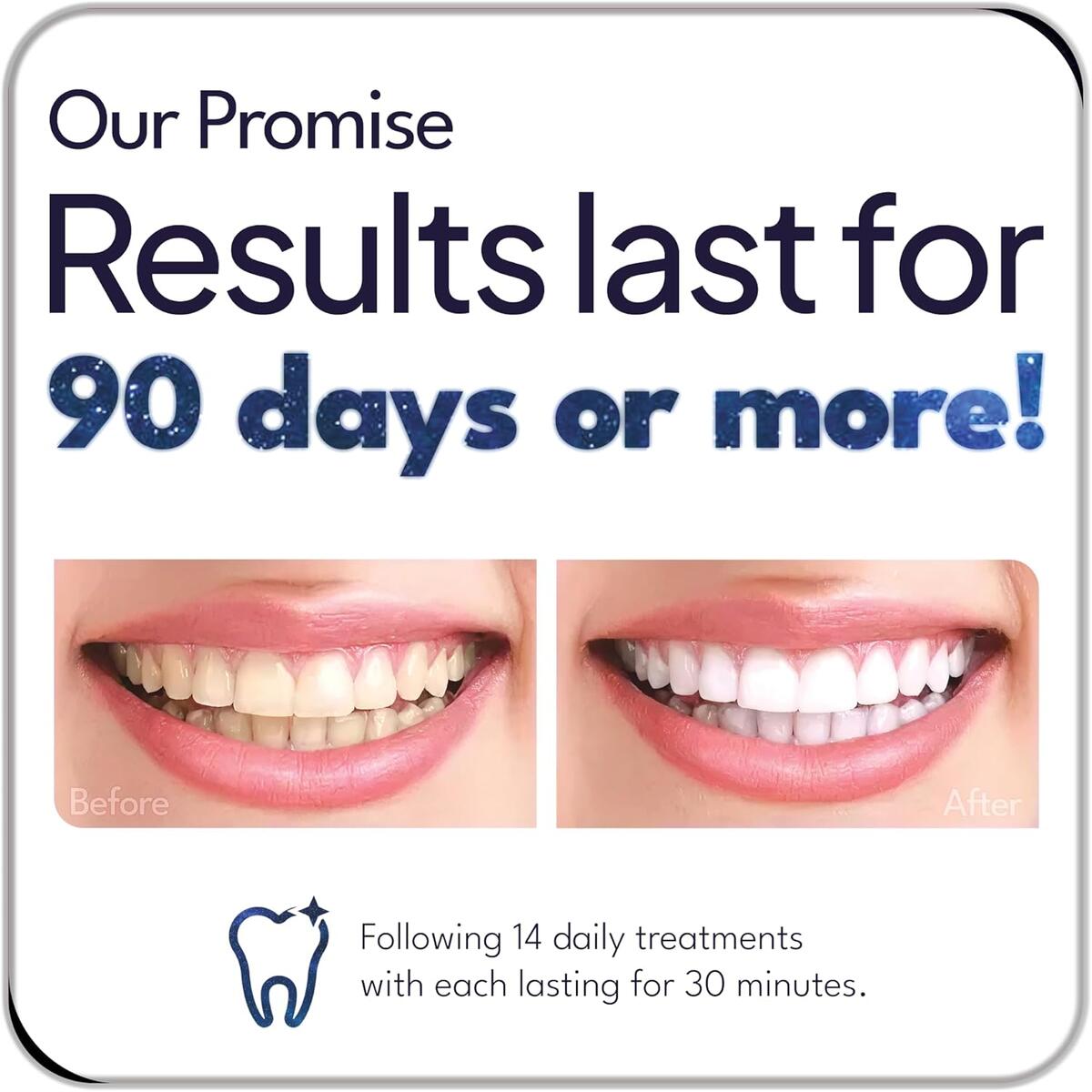 Teeth Whitening Strips 18 Cashback Rebates - RebateKey