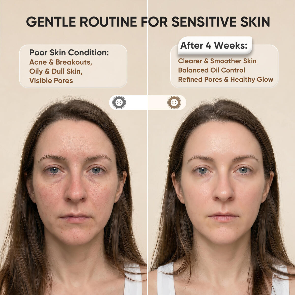 Red Light Therapy For Face 12 Cashback - RebateKey