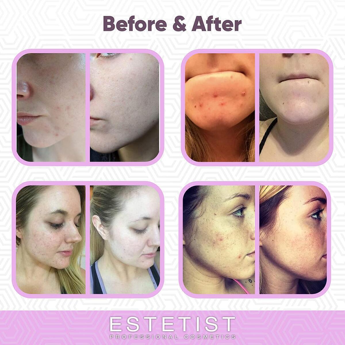 Purifying Pink Face Mask Cashback - RebateKey