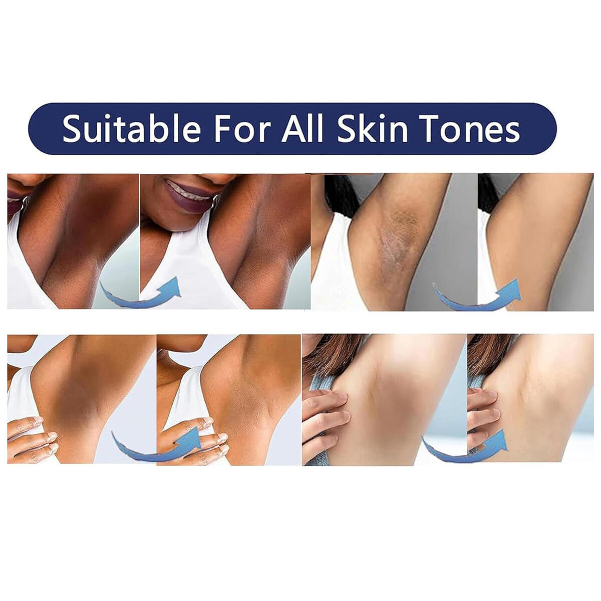 Skin Bleaching Cream 5 Cashback - RebateKey