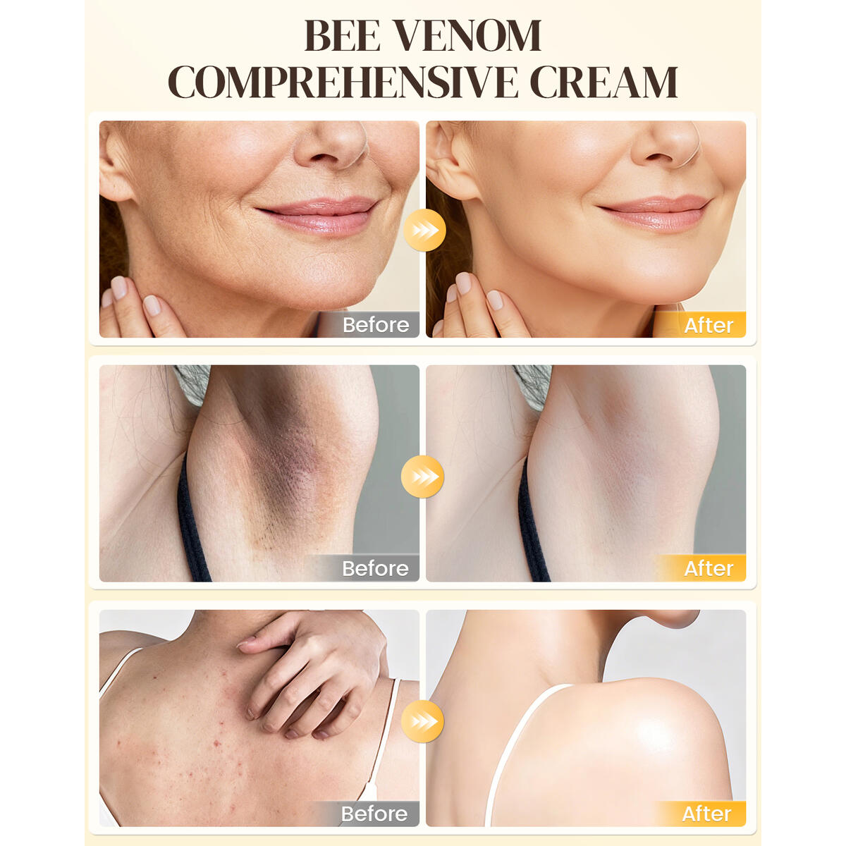 Bee Venom Comprehensive Cream 1 Cash Back - RebateKey