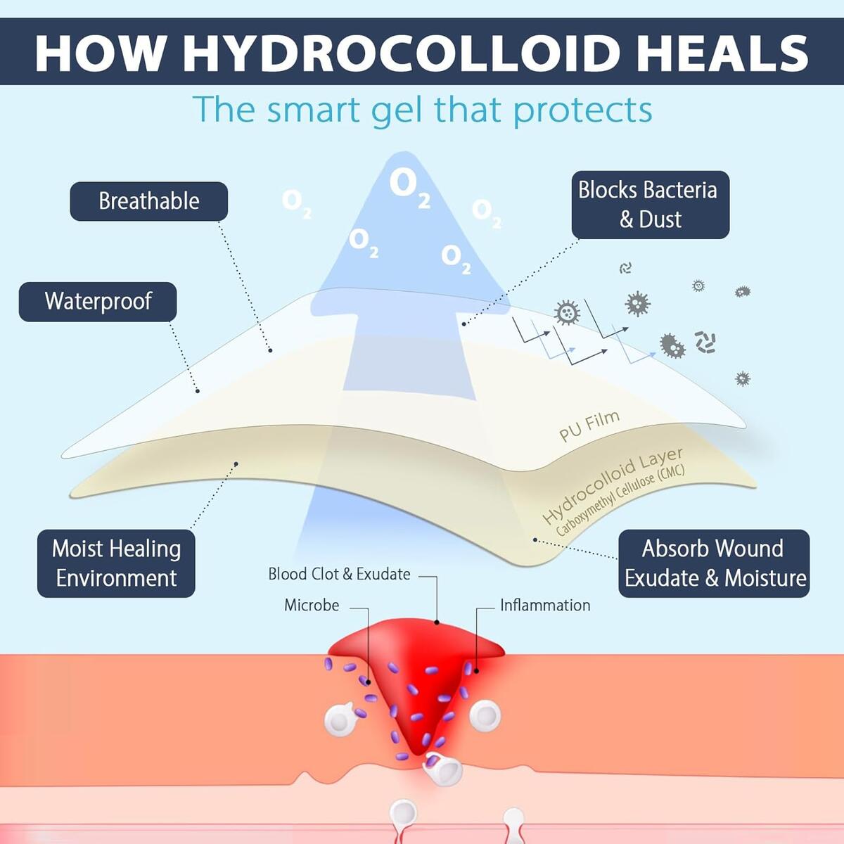Hydrocolloid Roll Gel Bandages For Wounds 1 Cashback Rebates - RebateKey