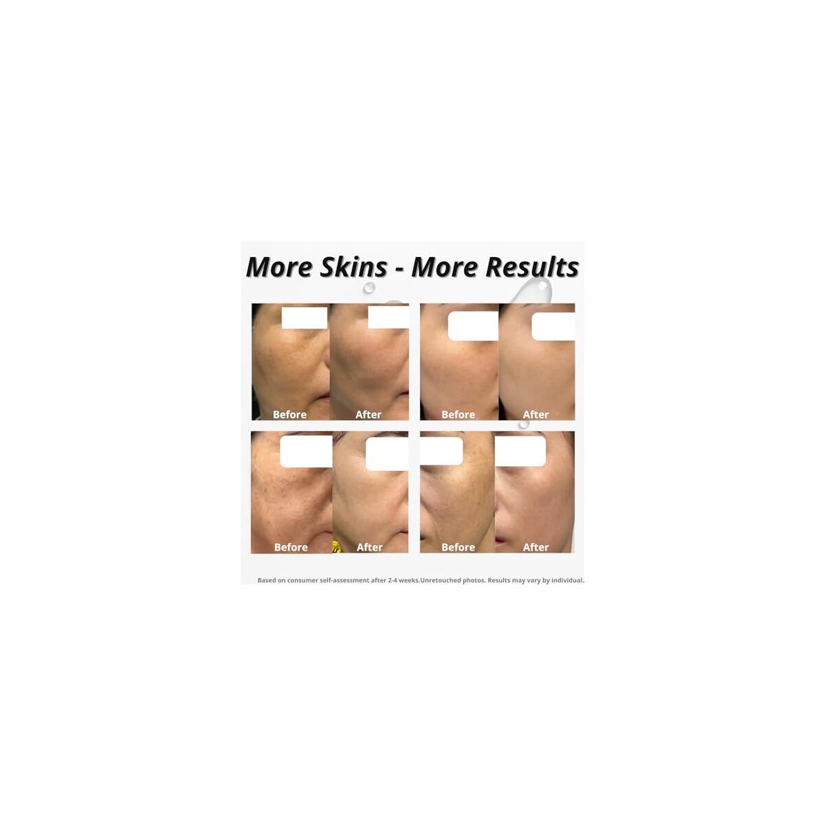 Anti Wrinkle Firming Serum With Tranexamic Acid An Cash Back - RebateKey