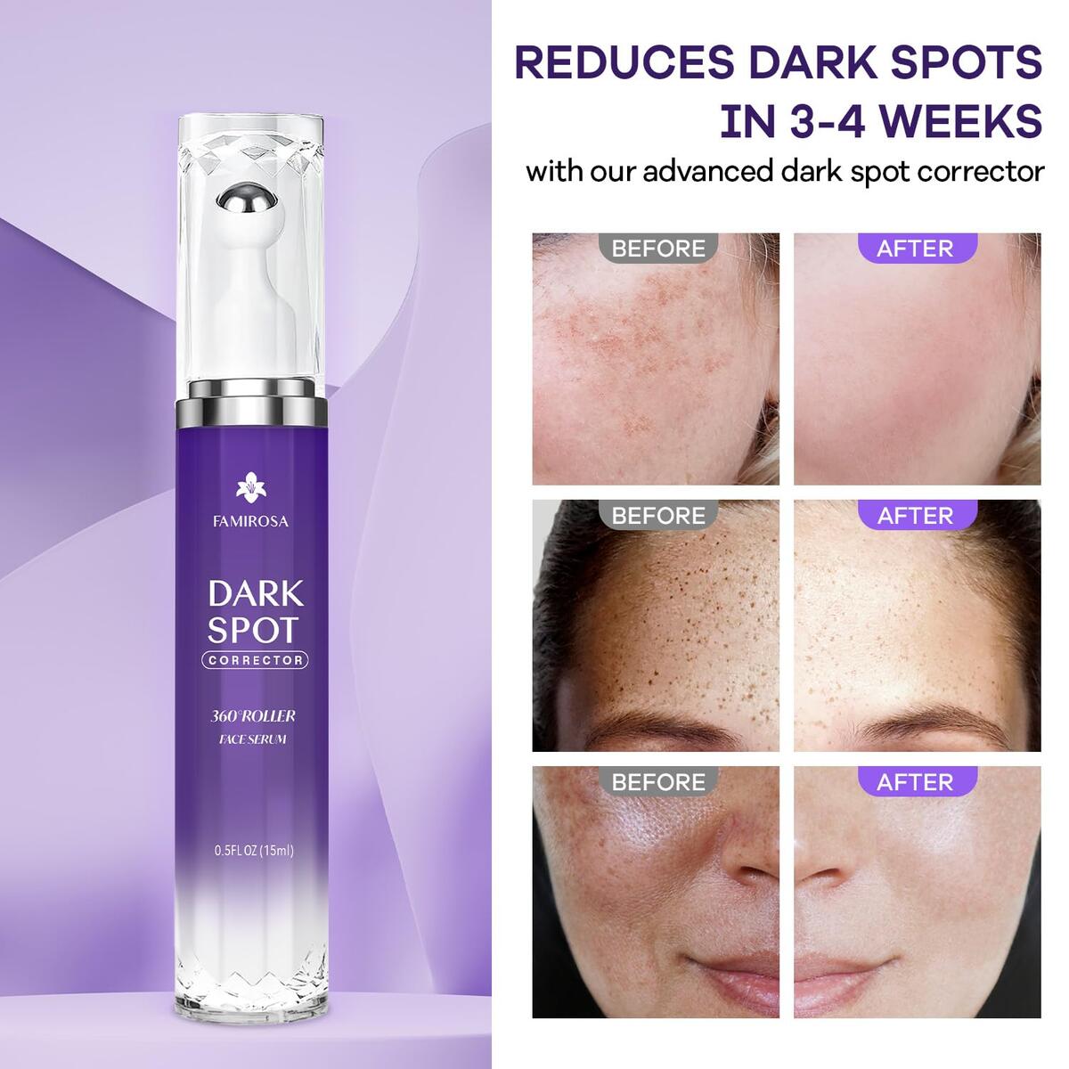 Dark Spot Corrector Serum Cashback Rebates - RebateKey