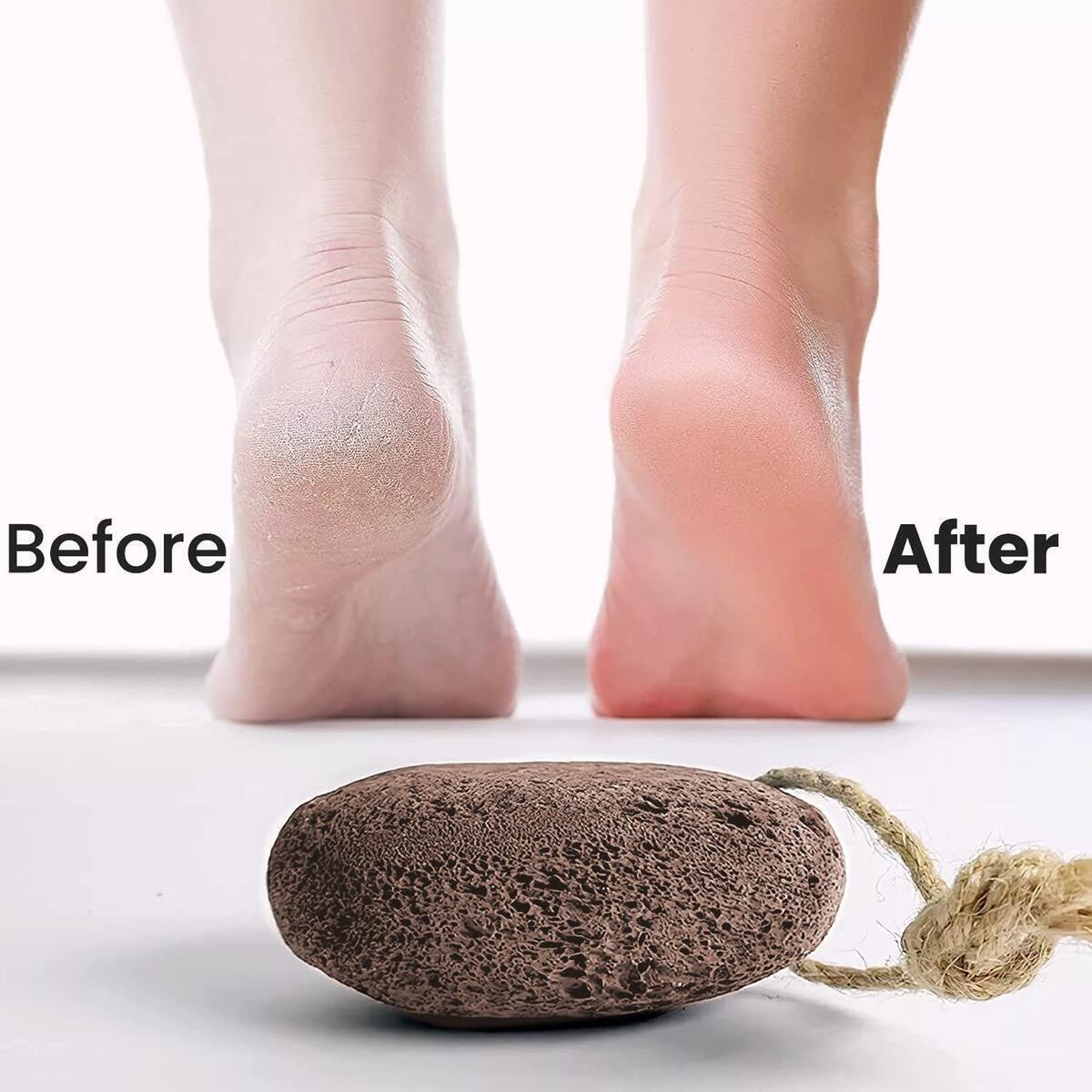 Foot Pumice Stone Cashback Rebate - RebateKey