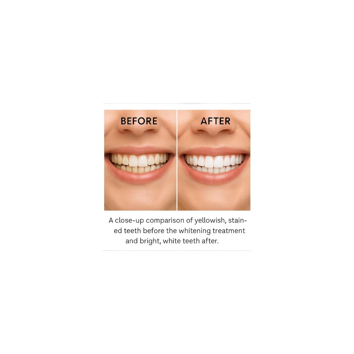 Teeth Whitening Strips 17 Rebate - RebateKey