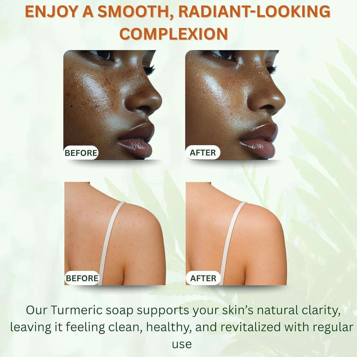 Turmeric Soap Bar For Face Body 7 Cash Back - RebateKey