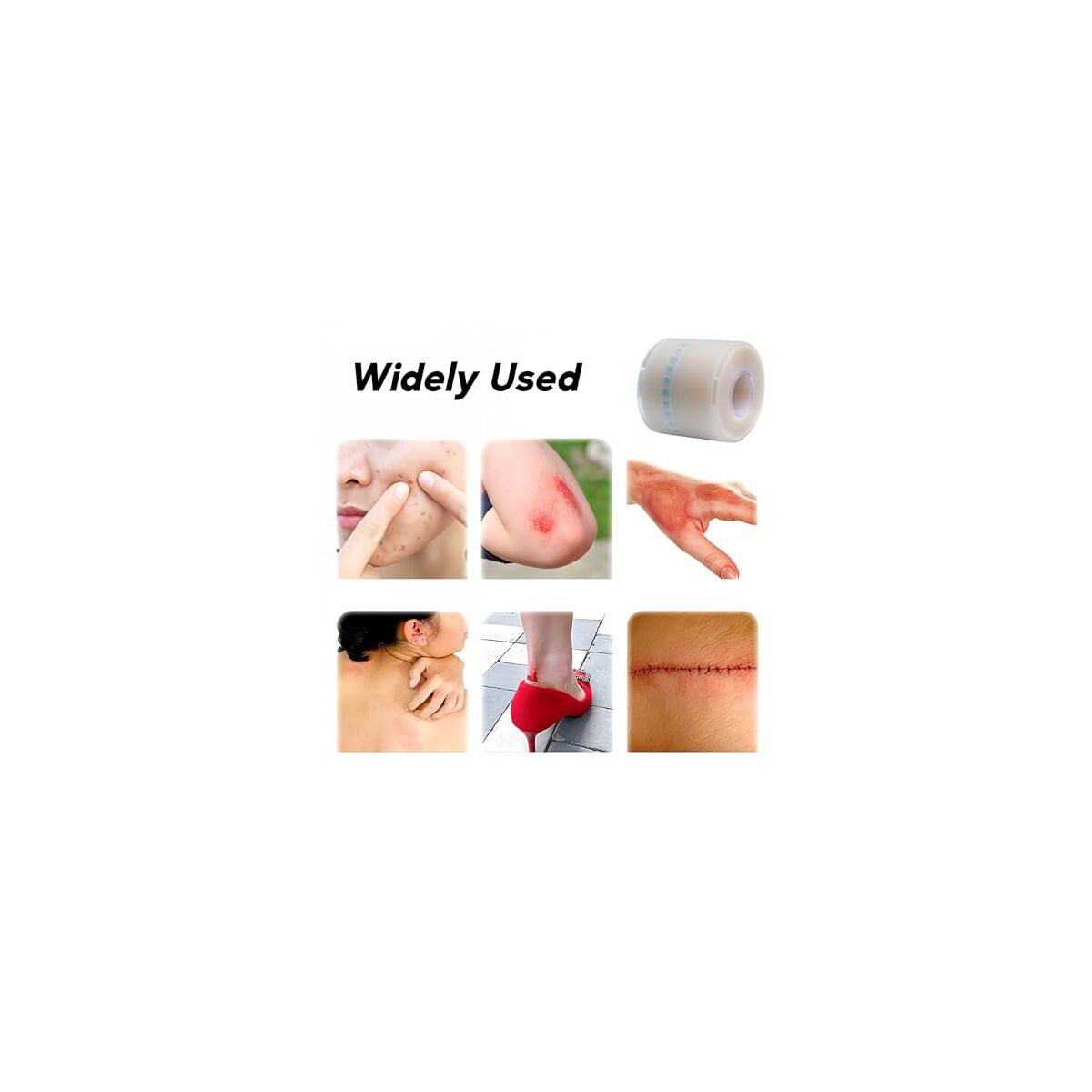 Hydrocolloid Bandages Roll 2 5 Cashback Rebates - RebateKey