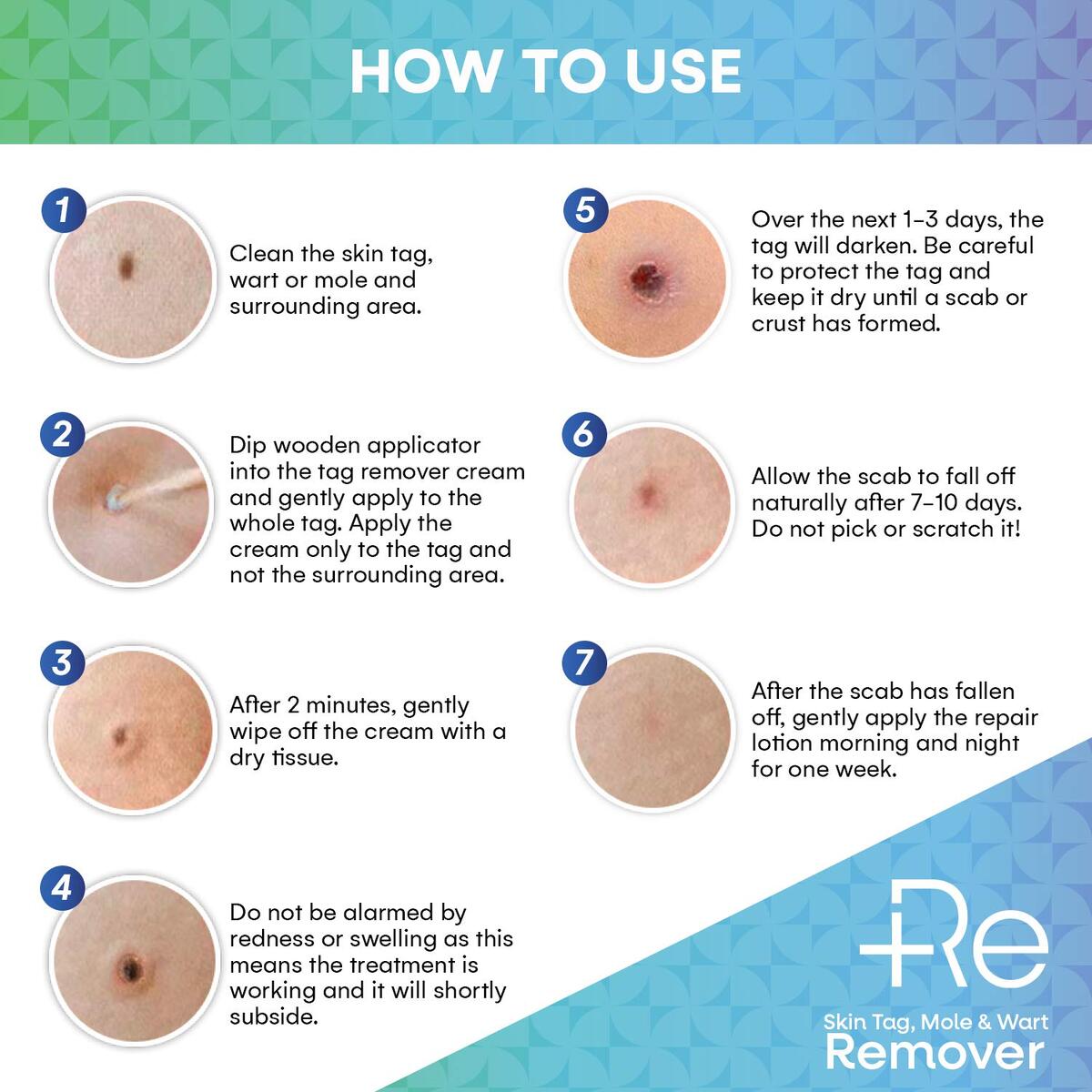 Mole Remover 1 Cashback Rebate - RebateKey