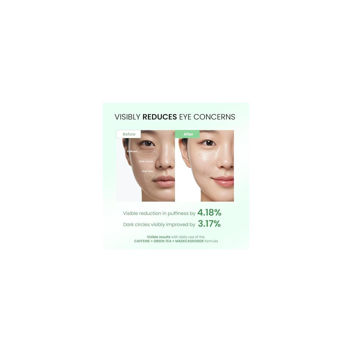 Eye Cream For Dark Circles 2 Cashback Rebate - RebateKey