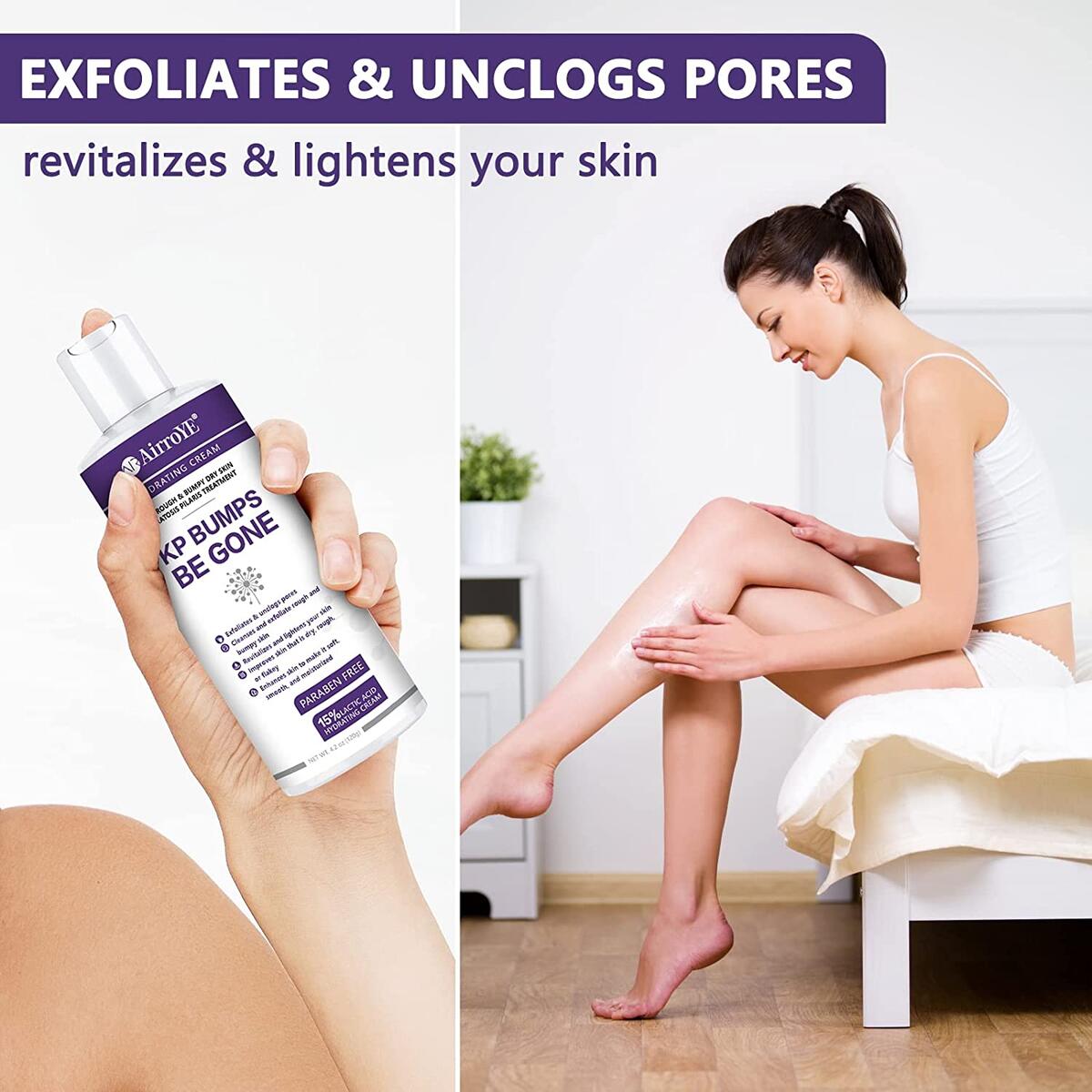 Keratosis Pilaris Treatment Cashback Rebates - RebateKey
