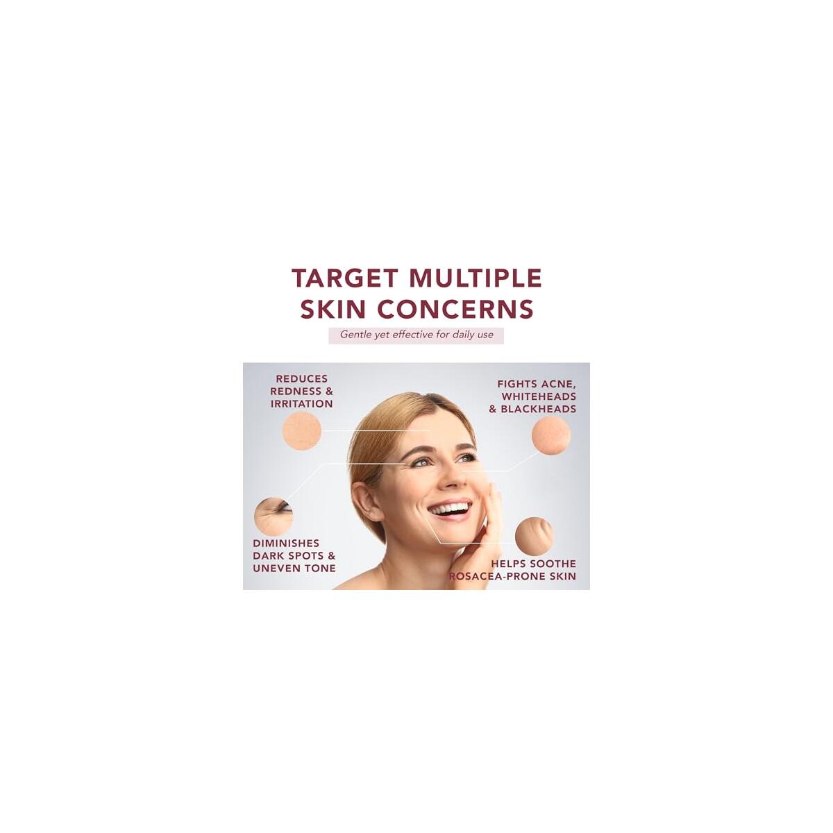 Azelaic Acid Cashback Rebates - RebateKey