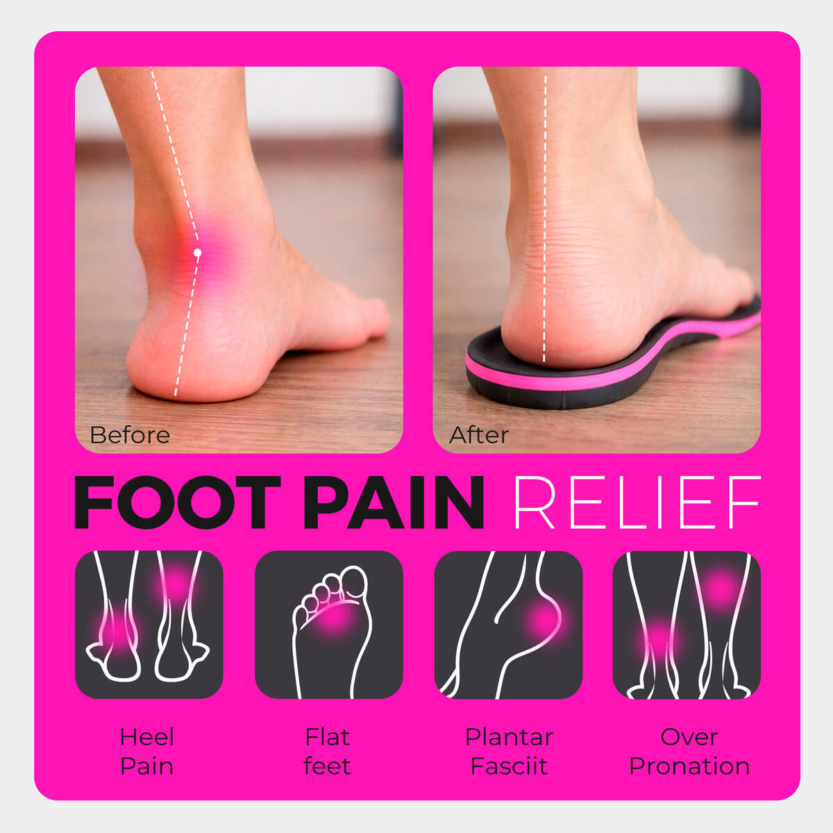 Plantar Fasciitis Insoles 1 Rebates - RebateKey