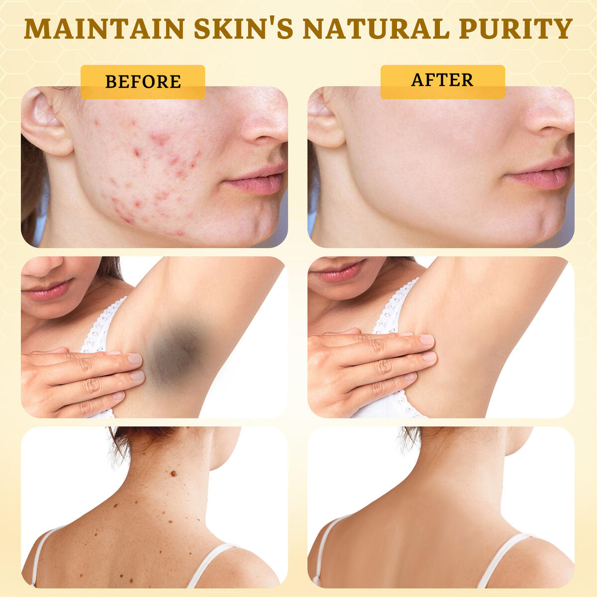 Bee Venom Comprehensive Cream Cash Back - RebateKey