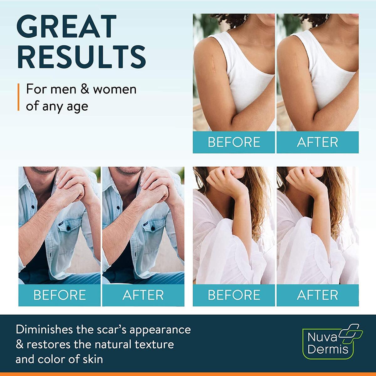 Silicone Scar Removal Sheets Cashback Rebate - RebateKey