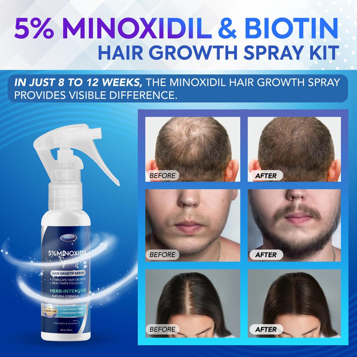 Minoxidil Hair Growth Spray Kit Rebates - RebateKey