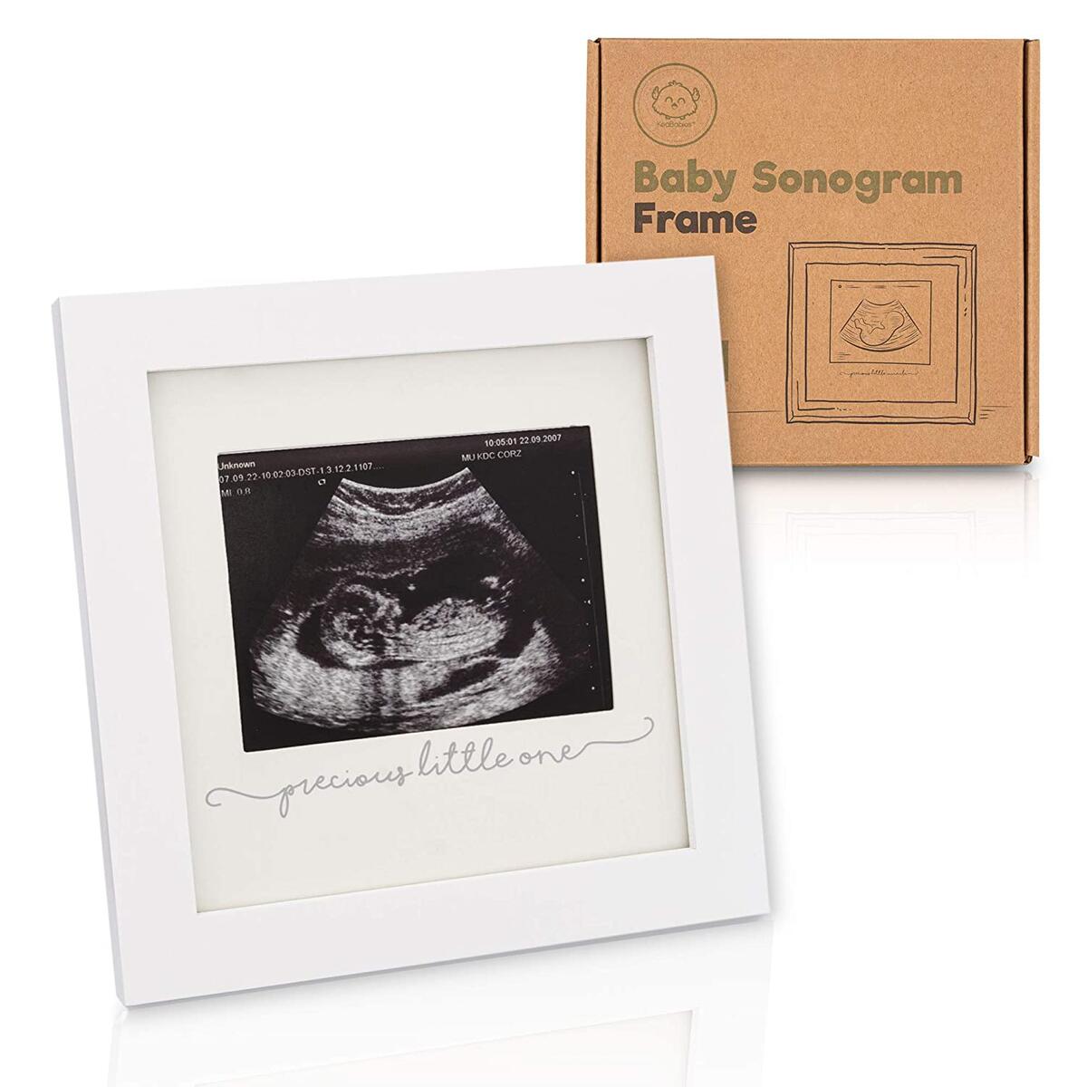 Sonogram Frame Cashback Rebate RebateKey