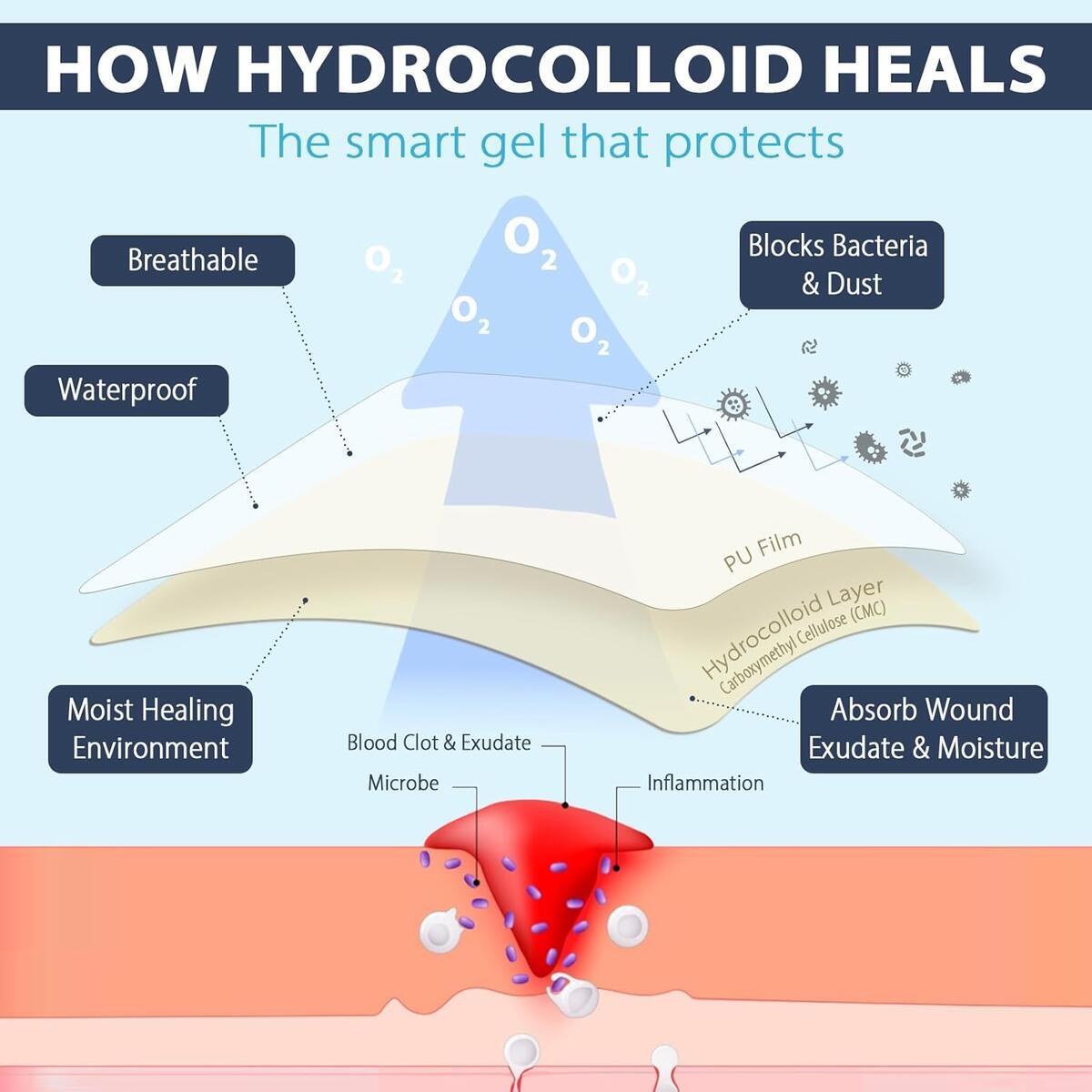 Hydrocolloid Roll Gel Bandages For Wounds 2 Rebate - RebateKey
