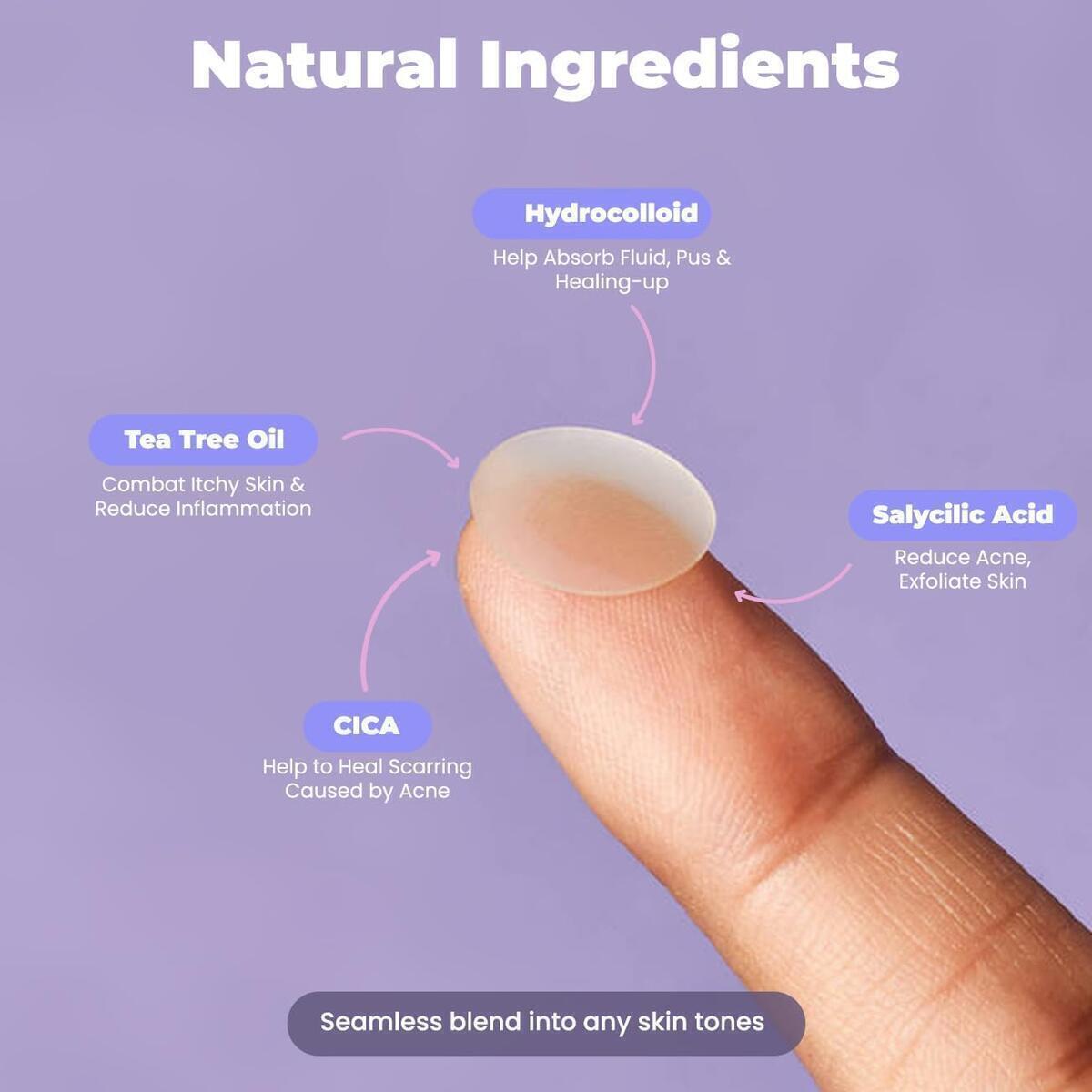 Roselynboutique Pimple Patches 1 Cashback - RebateKey