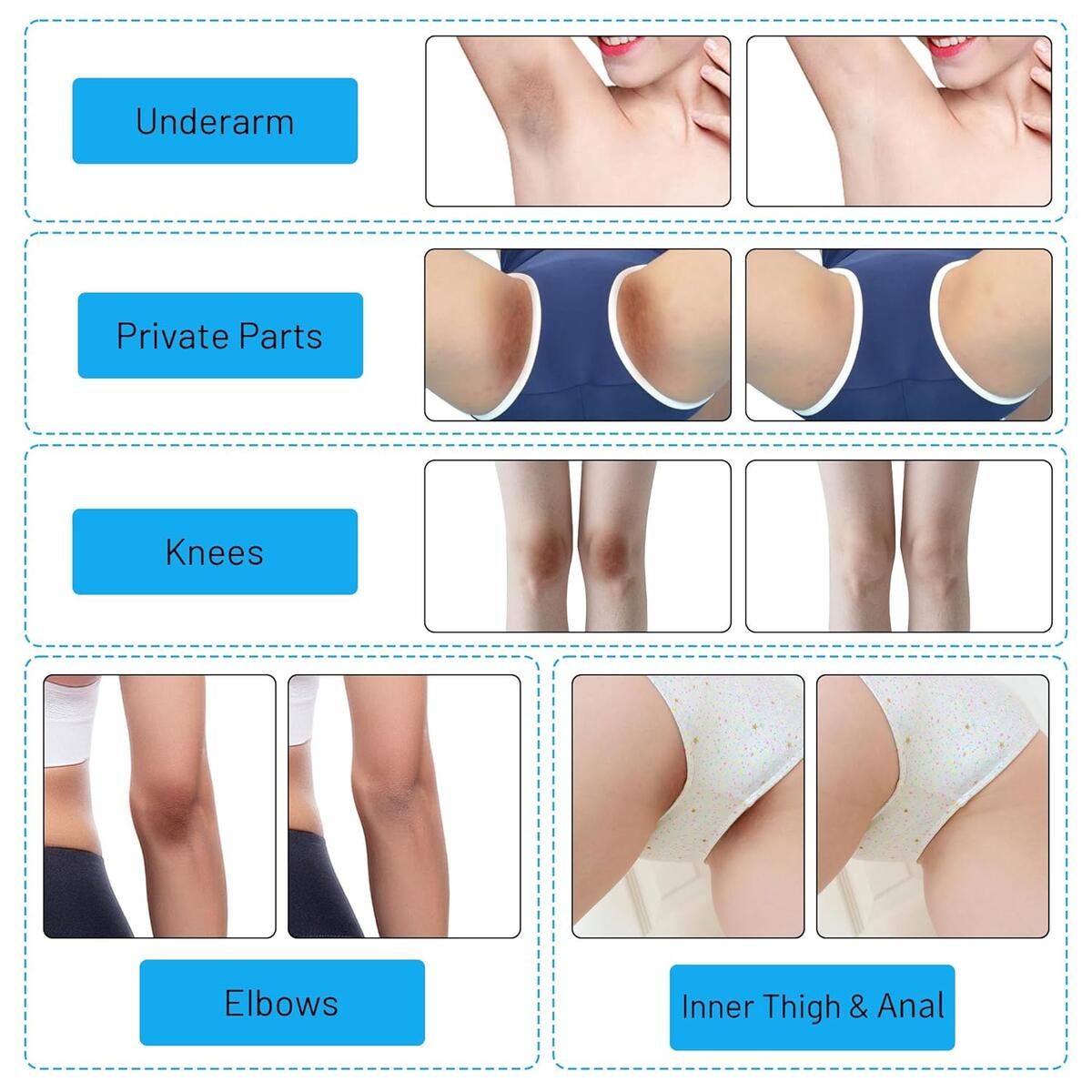Skin Whitening Cream 6 Cashback - RebateKey
