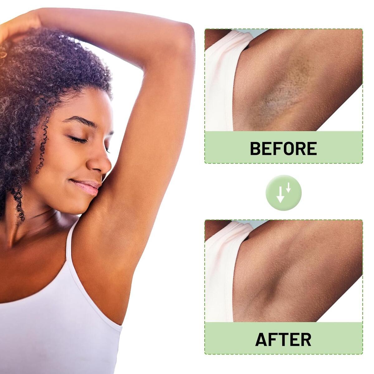 Bleaching Cream For Intimate Areas Rebate - RebateKey