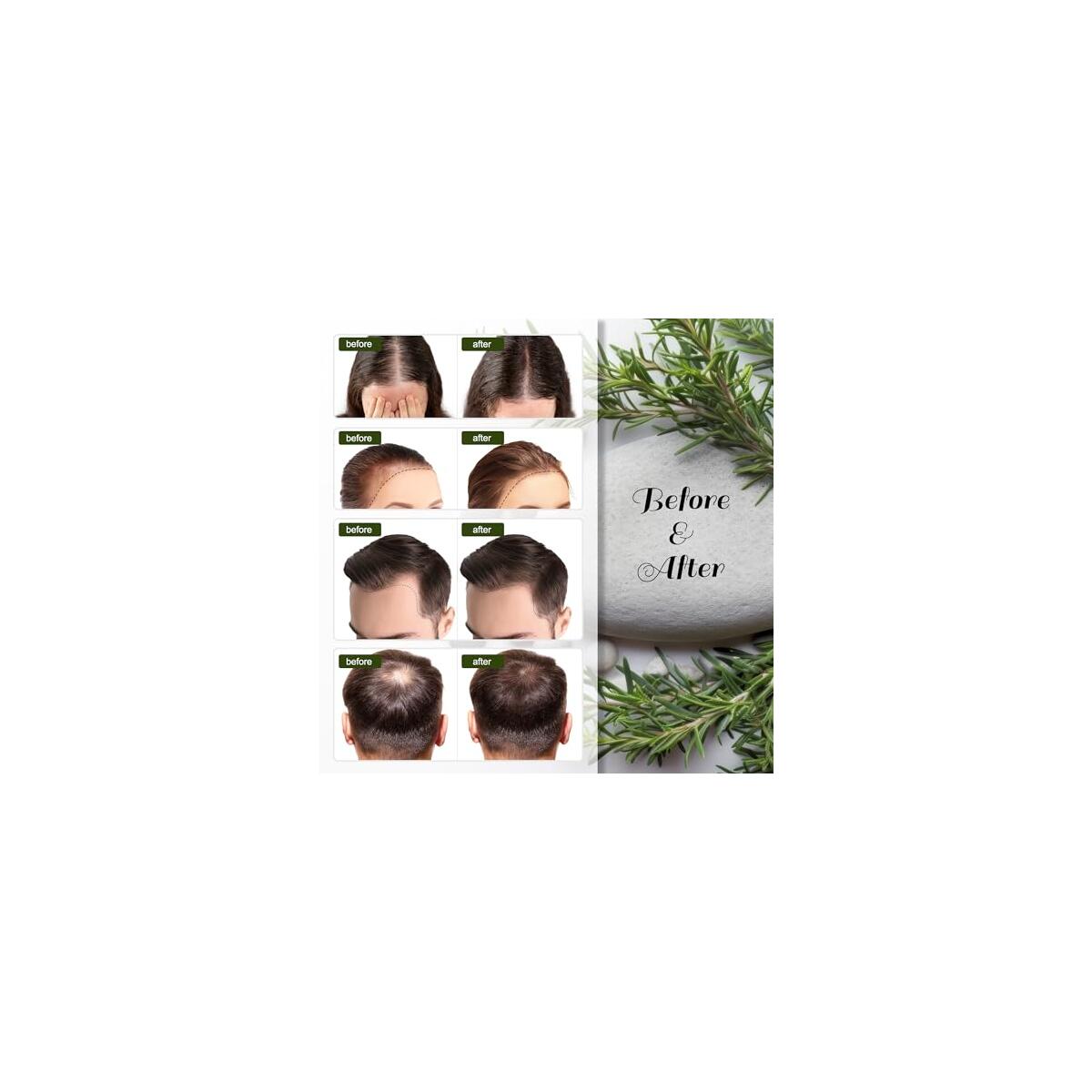 Rosemary Hair Growth Cashback Rebate - RebateKey