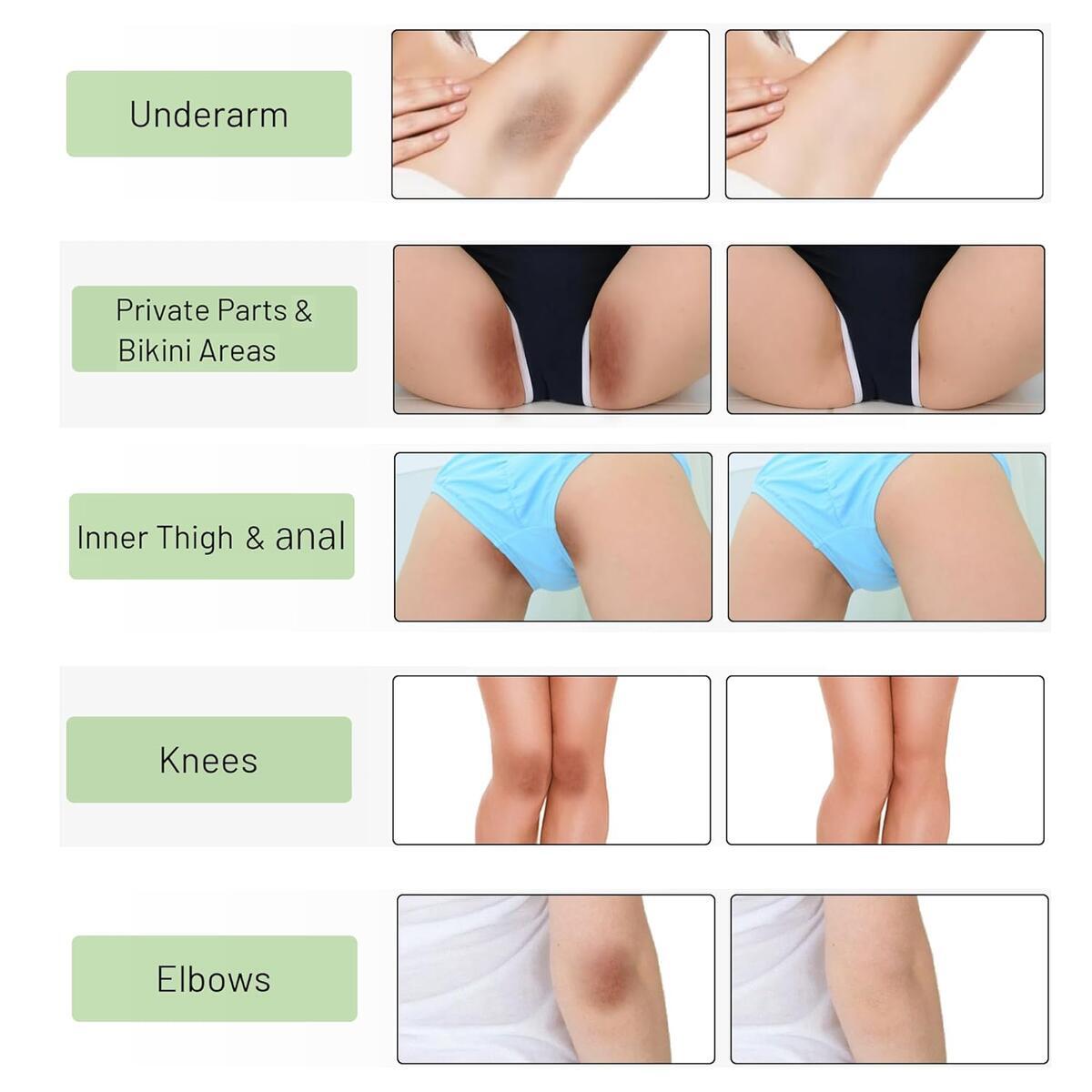 Bleaching Cream For Intimate Areas Rebate - RebateKey