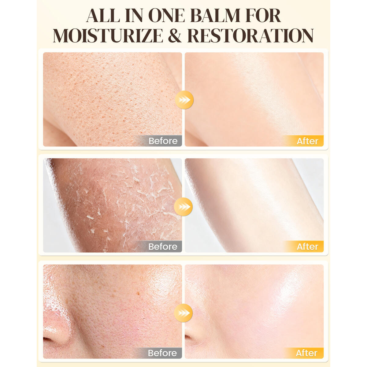 Bee Venom Comprehensive Cream 3 Rebate - RebateKey