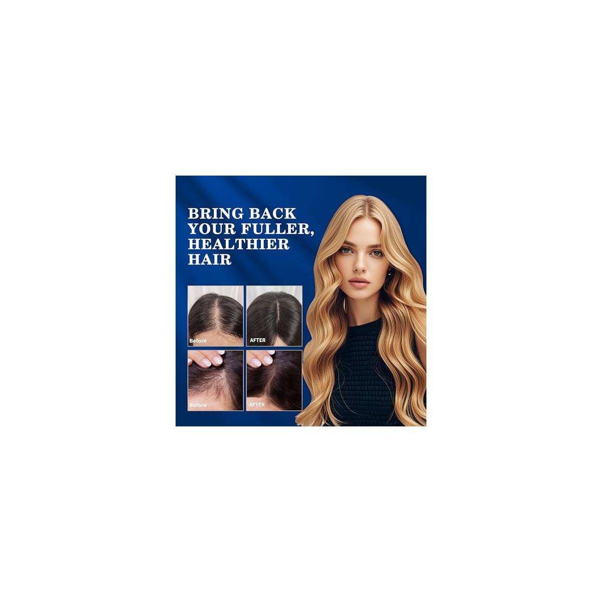 Minoxidil Spray 2pcs With Roller Rebate - RebateKey