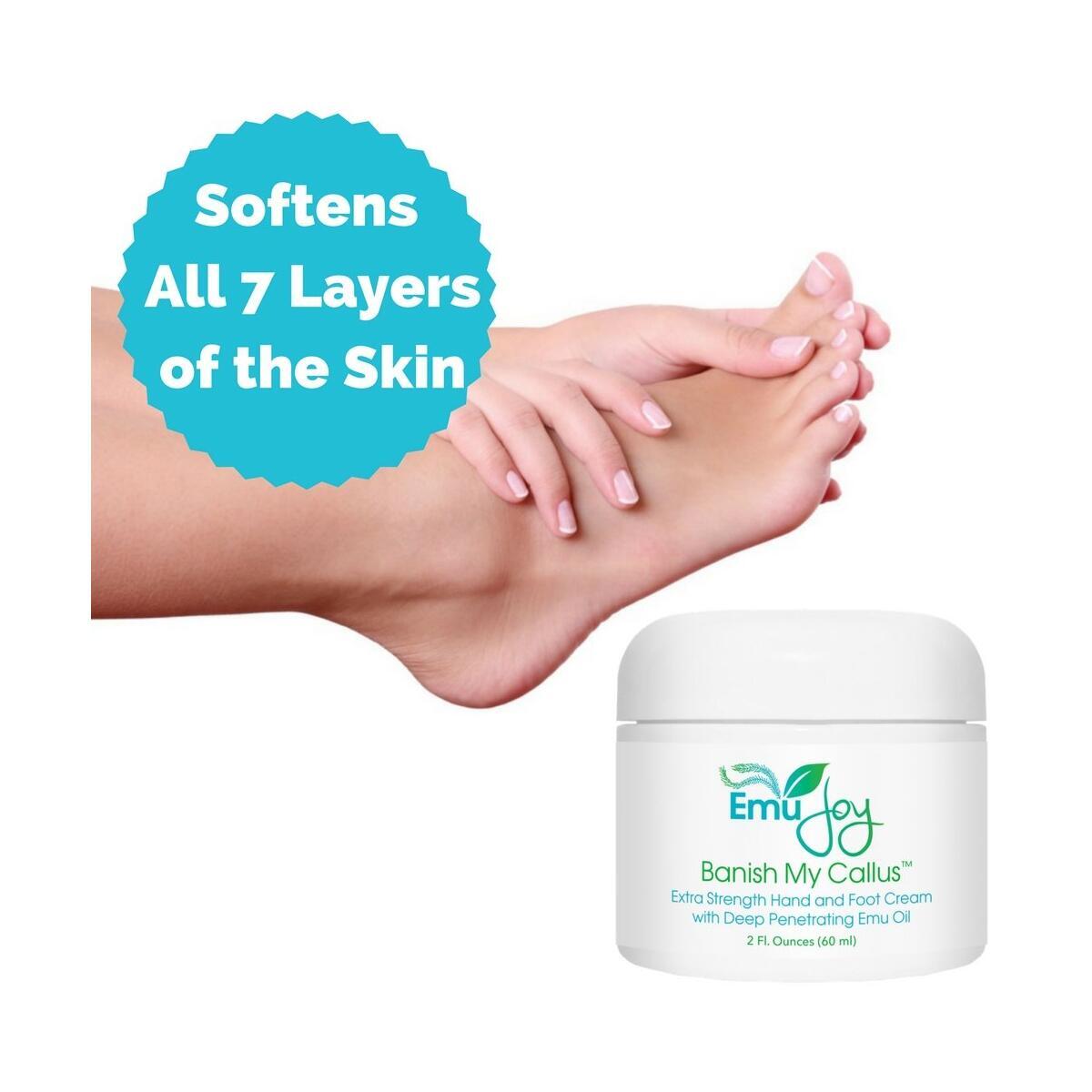 Callus Remover Cream Rebates - RebateKey