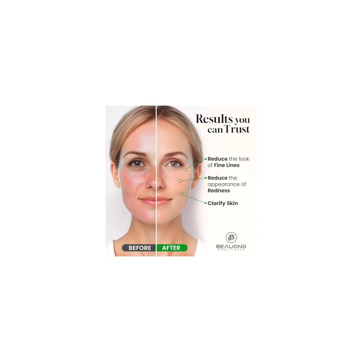 Castor Oil For Face 1 Cashback - RebateKey