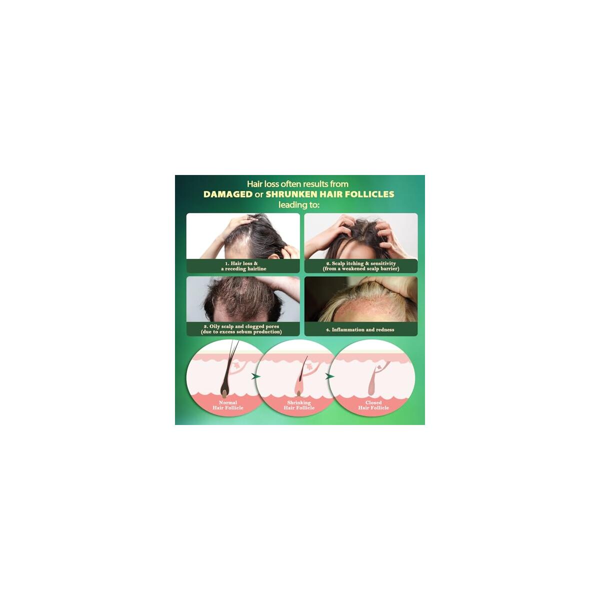 Scalpy Herbal Hair Growth Serum For Thicker Hair Cash Back - RebateKey