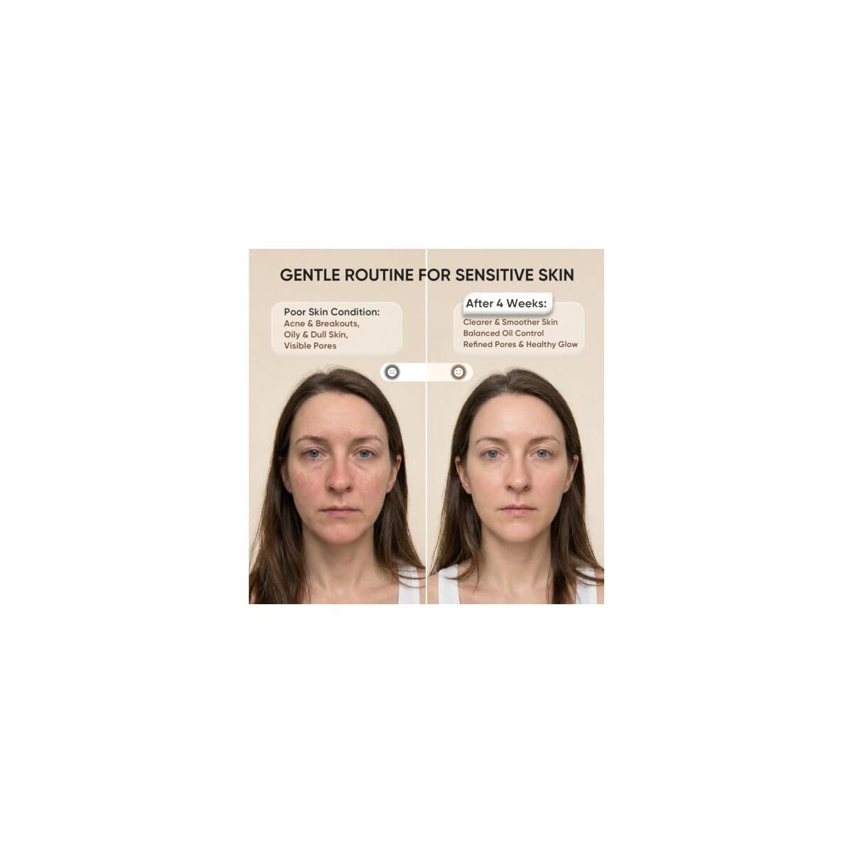 Led Face Mask Light Therapy 5 Cashback Rebate - RebateKey