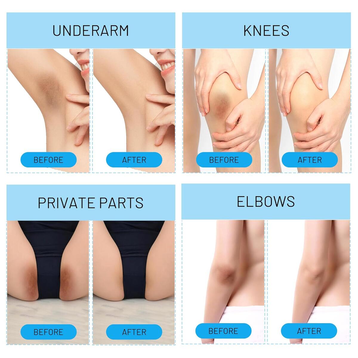 Skin Whitening Cream 8 Cash Back - RebateKey