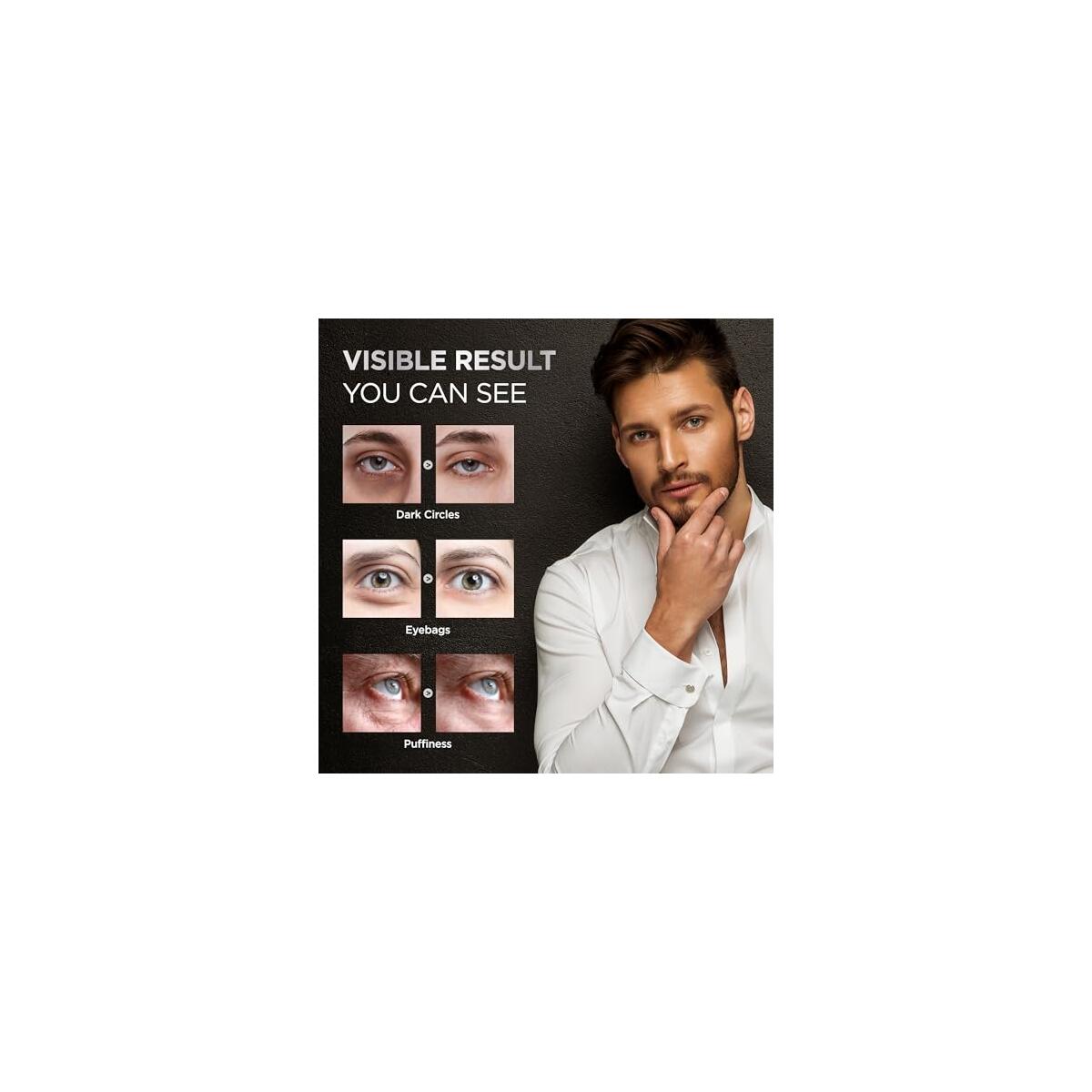 Eye Bags Treatment For Men Cashback - RebateKey