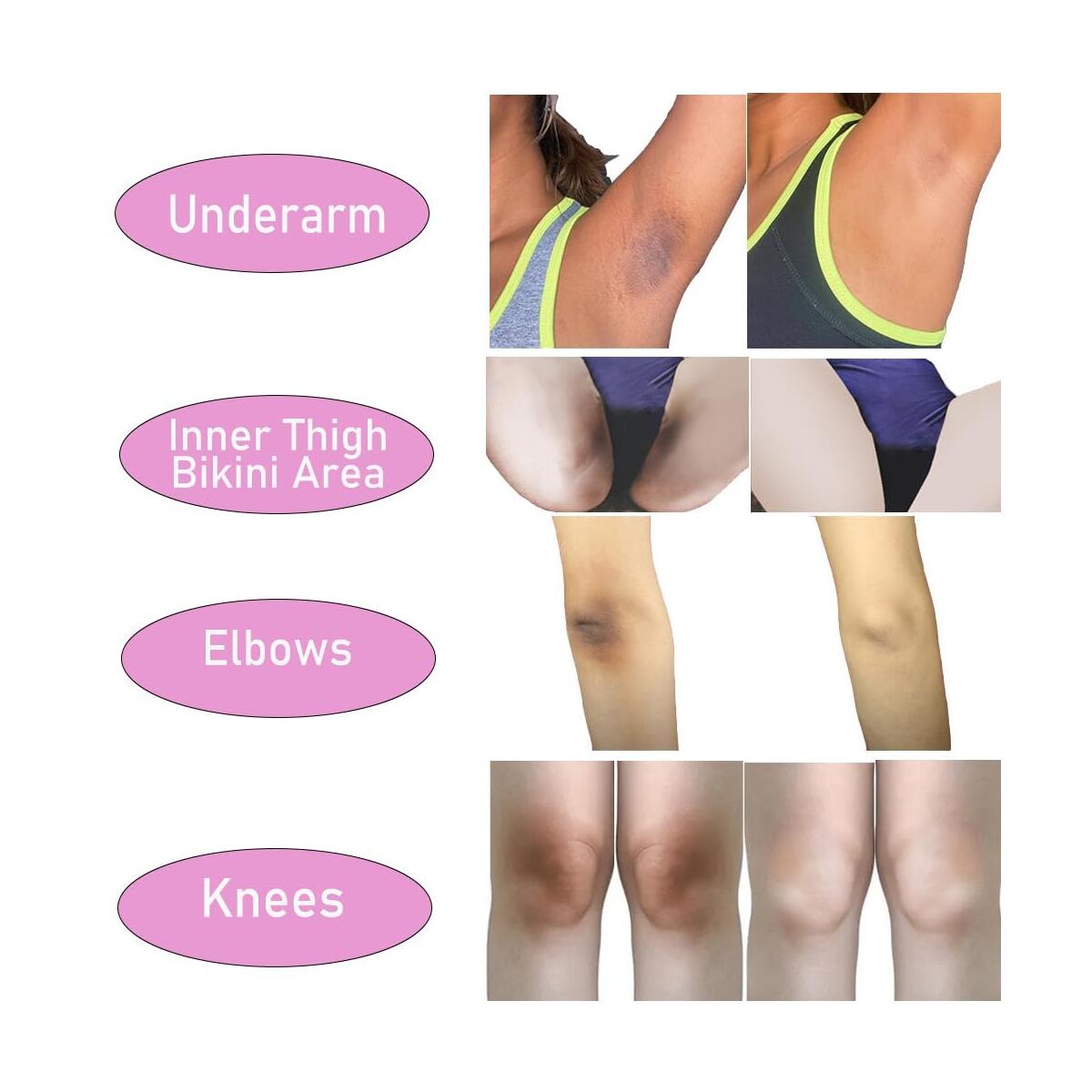 Whitening Cream Dark Rebates - RebateKey