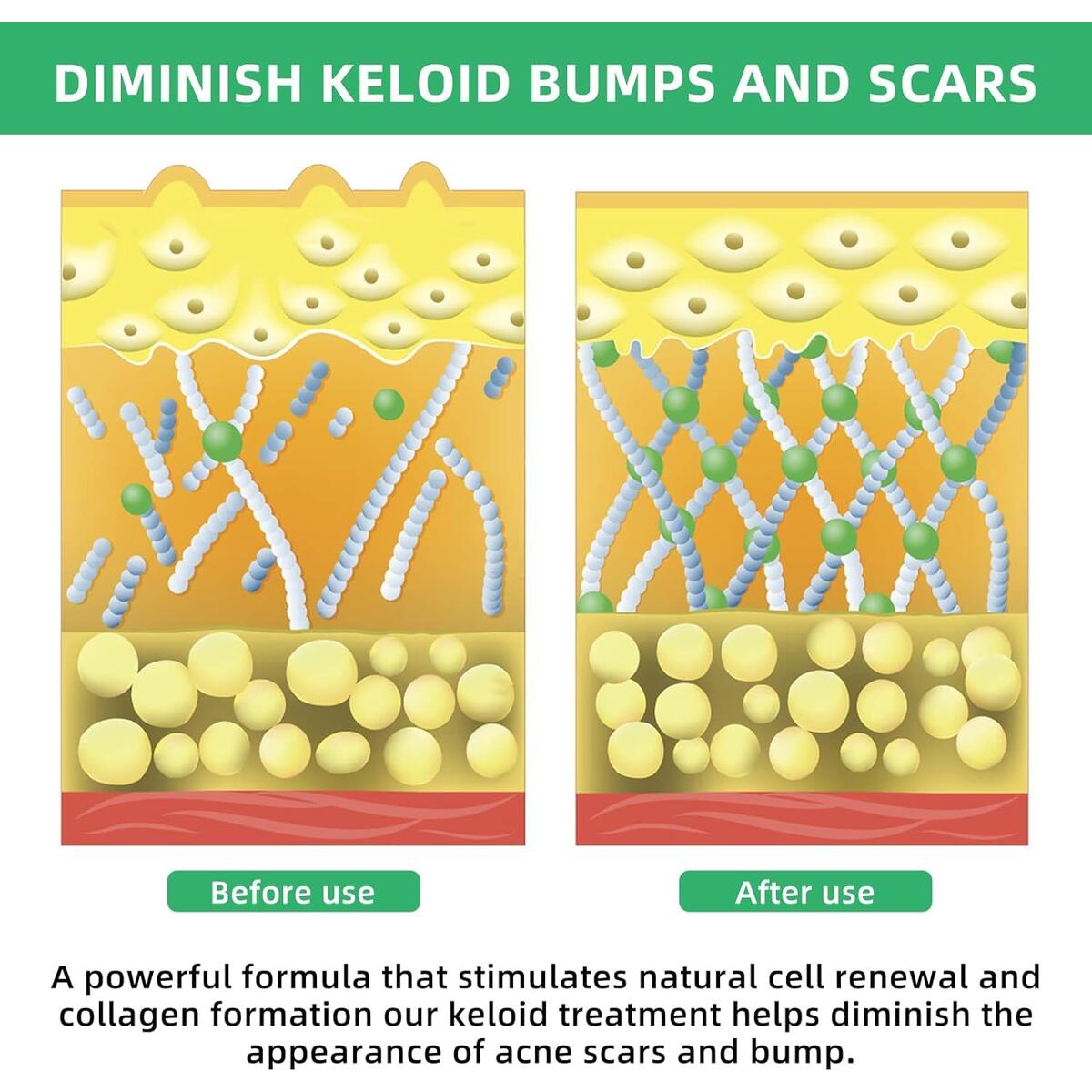 Keloid Bump Removal Cashback Rebates - RebateKey