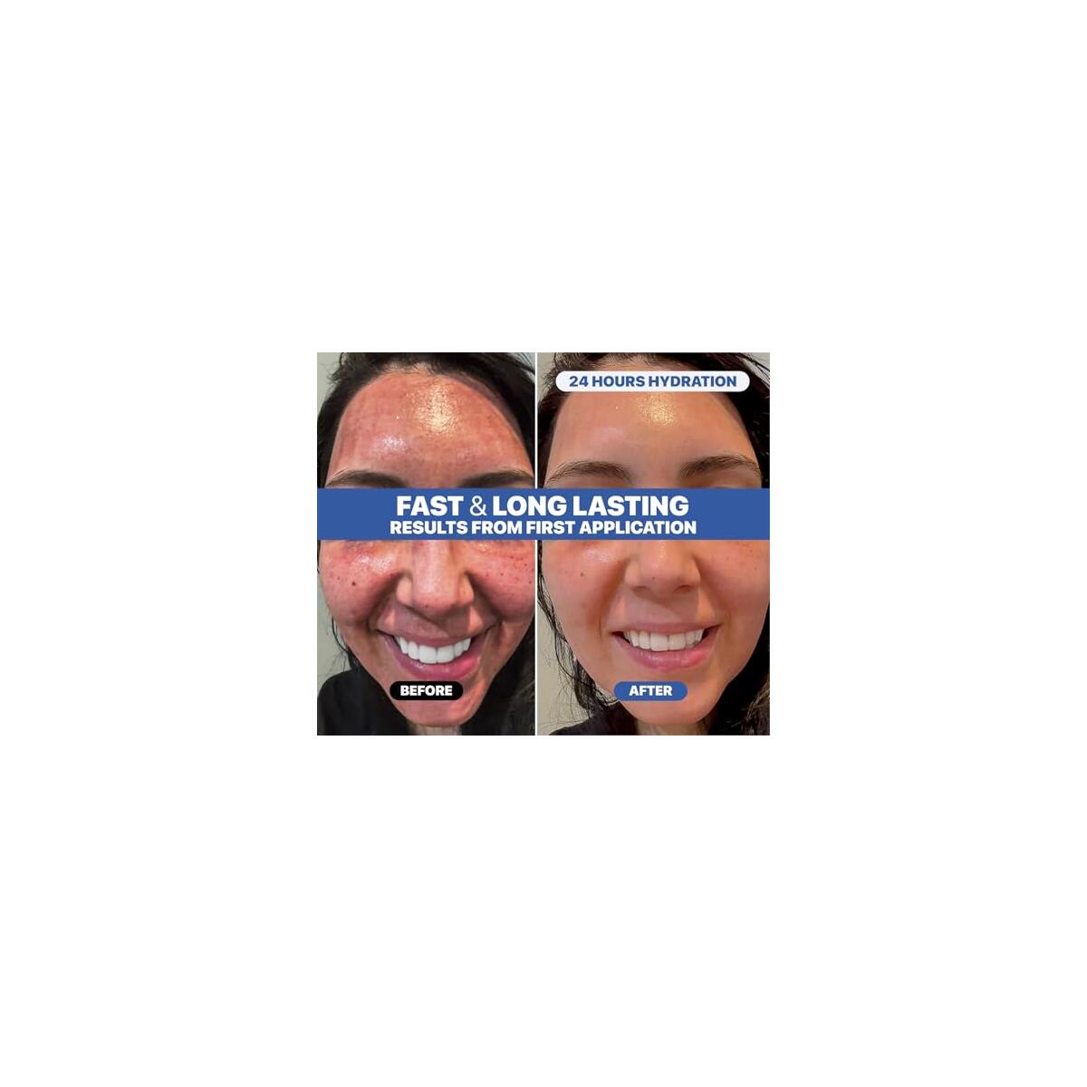 Dr Arsy Moisturizer Cashback Rebates - RebateKey