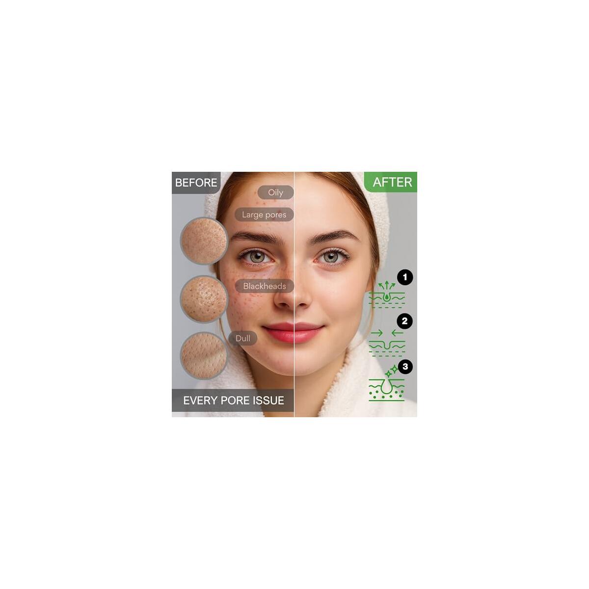 Blackhead Remover Mask Kit Cash Back - RebateKey