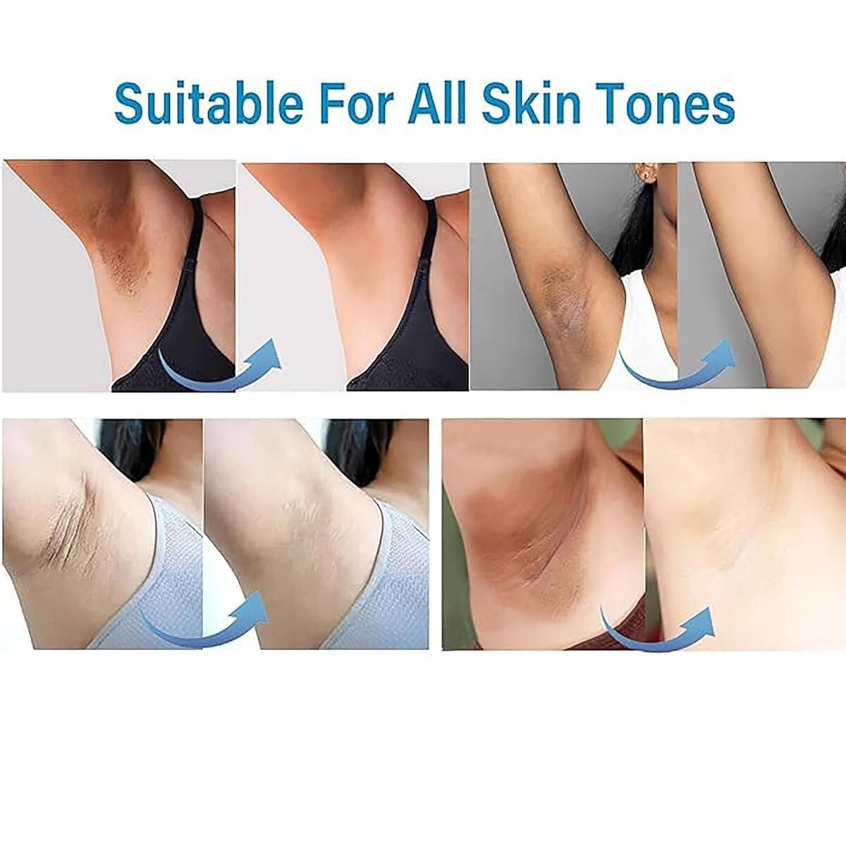 Meidian Skin Bleaching Cream Rebates - RebateKey