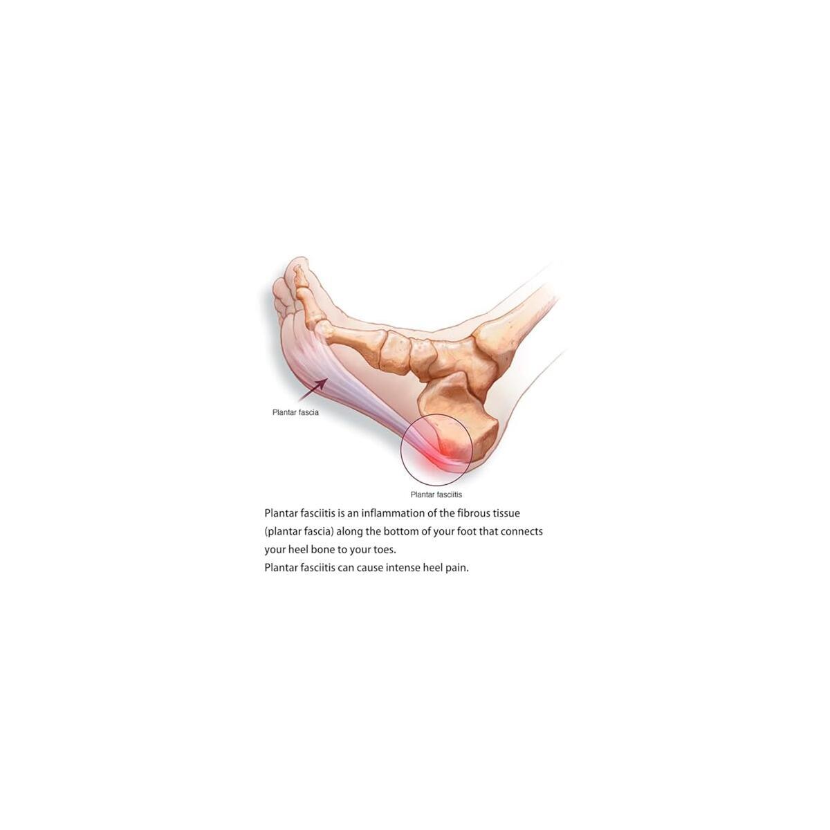 Arch Support Pad 1 Cashback Rebates - RebateKey