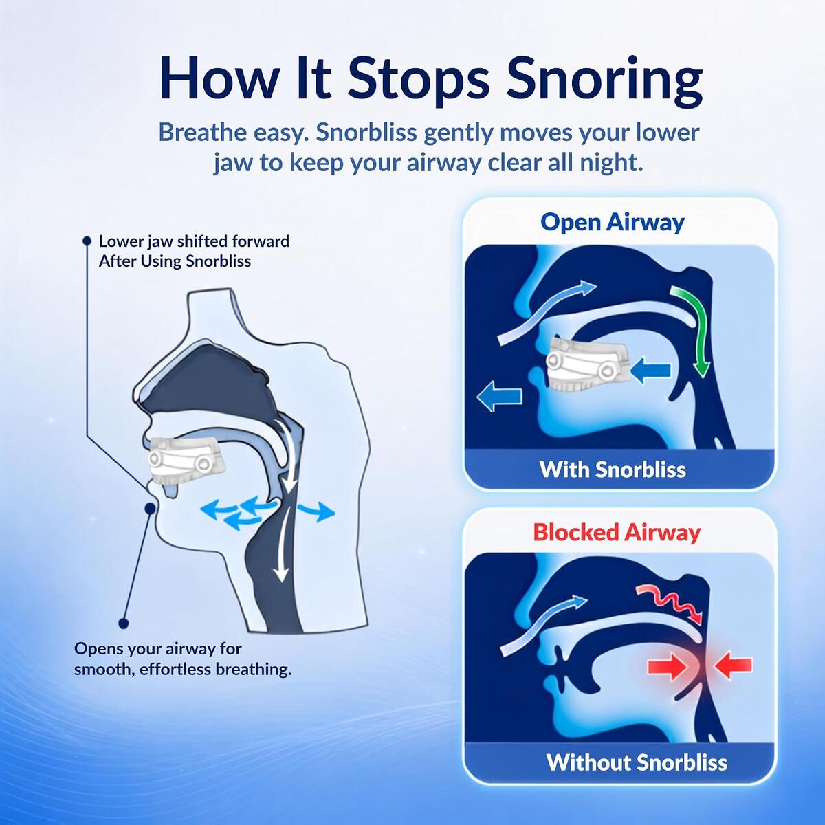 Snore Mouth Guard Cashback Rebates - RebateKey