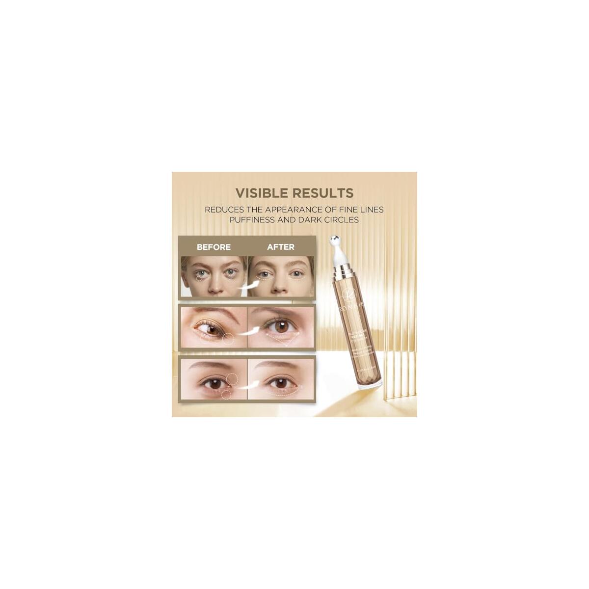 Eye Cream For Dark Circles 1 Cashback Rebate - RebateKey