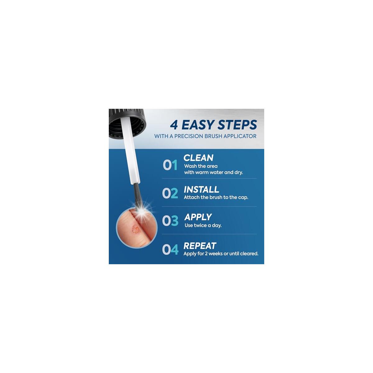 Uikeaft Wart Corn Remover Cashback - RebateKey