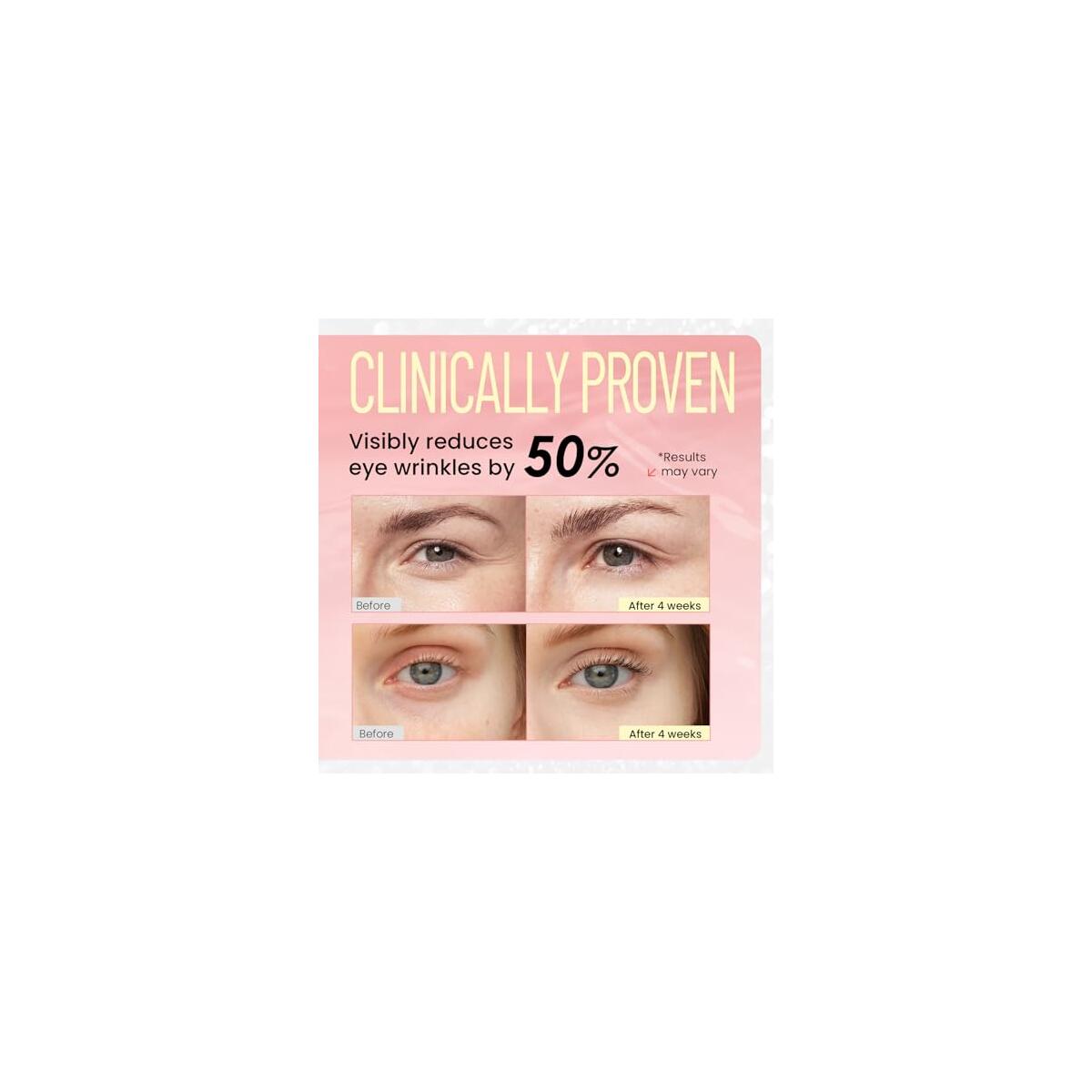 Retinol Eye Cream For Dark Circles Rebate - RebateKey