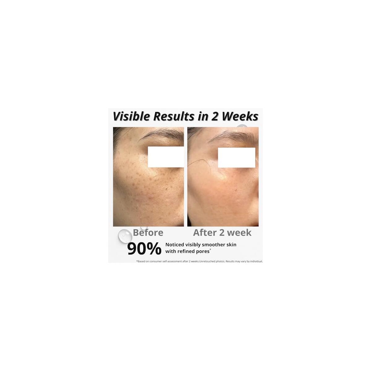 Anti Wrinkle Firming Serum With Tranexamic Acid An Cash Back - RebateKey