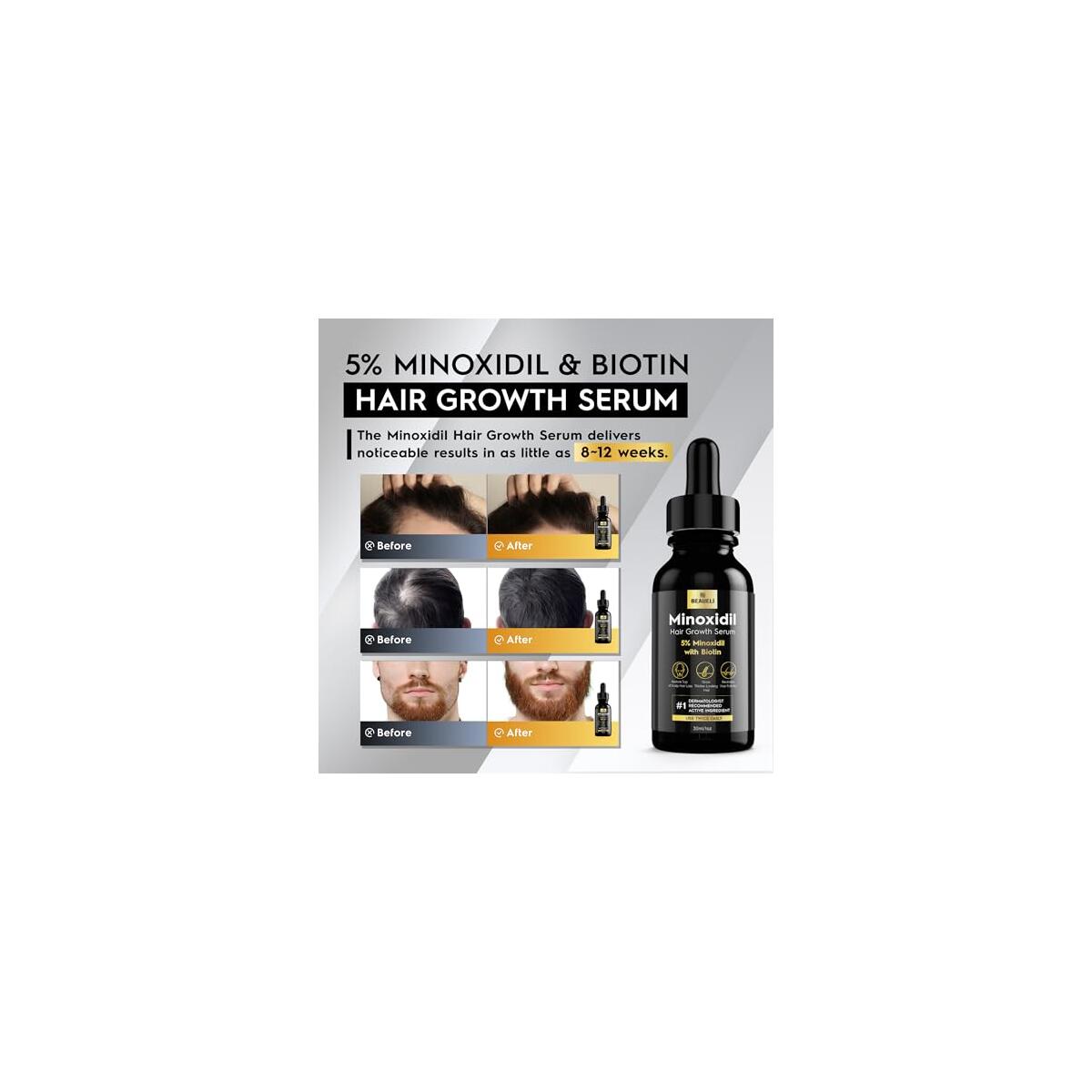 Beaueli Beaueli Minoxidil Hair Growth Serum Rebate - RebateKey